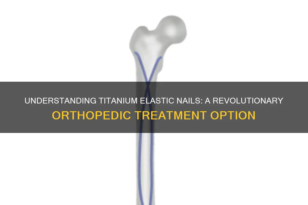 what is titanium elastic nail