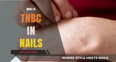Understanding TNBC in Nails: Causes, Symptoms, and Treatment Options