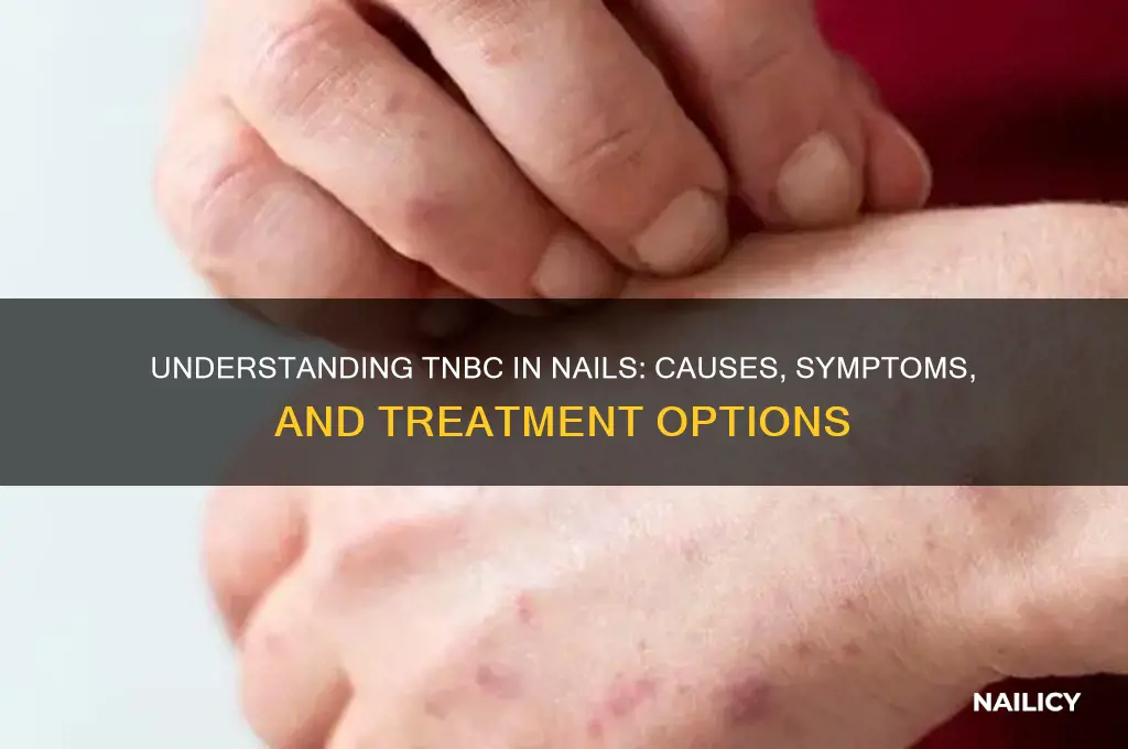 what is tnbc in nails