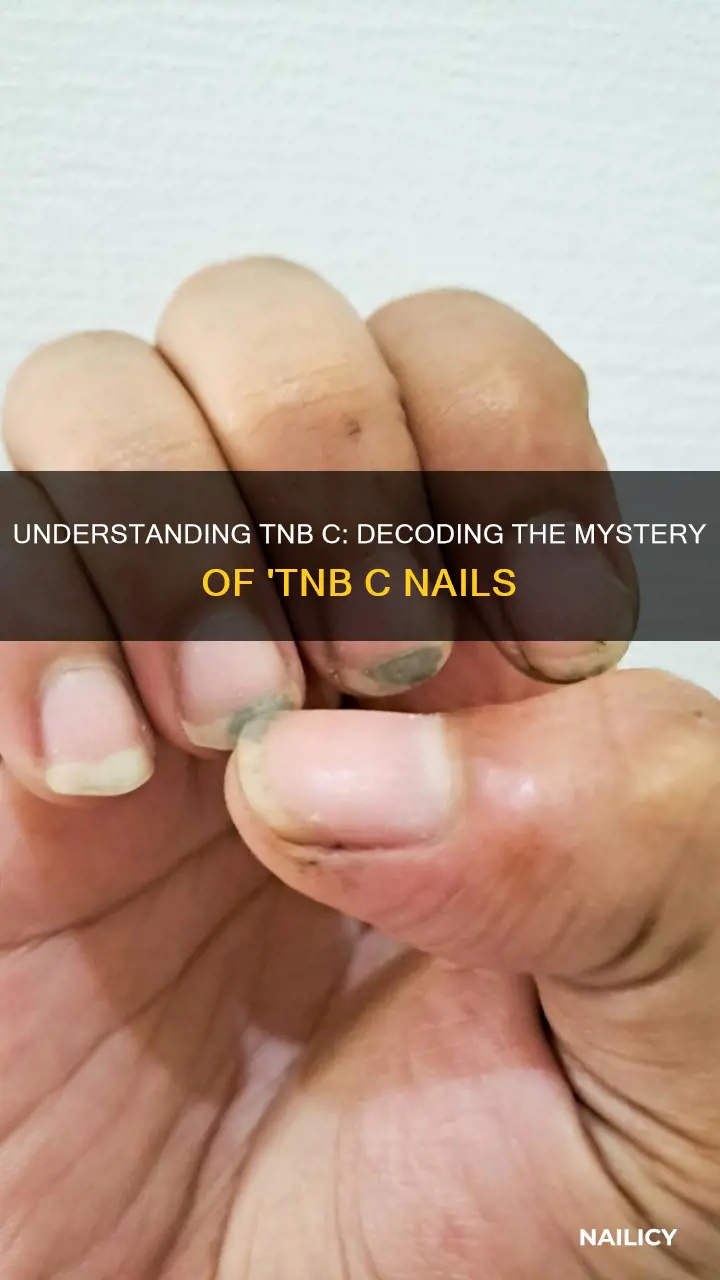 what is tnbc nails mean