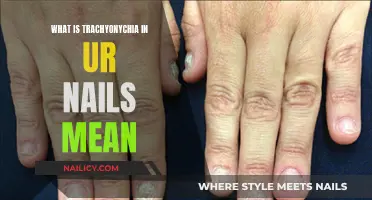 Unraveling the Mystery: Trachyonychia and Its Impact on Your Nails