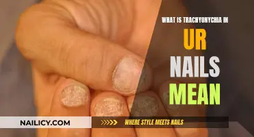 Trachyonychia: What Your Nails Are Trying to Tell You