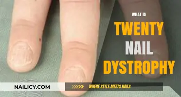 Understanding Twenty Nail Dystrophy: Causes, Symptoms, and Treatment Options