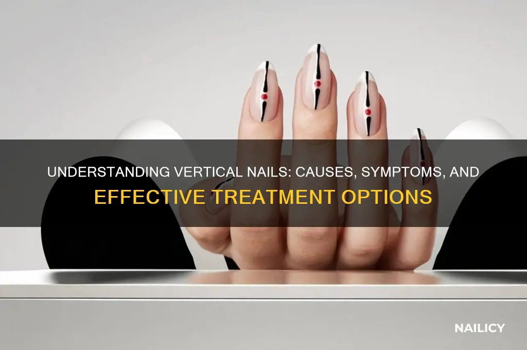 what is vertical nails