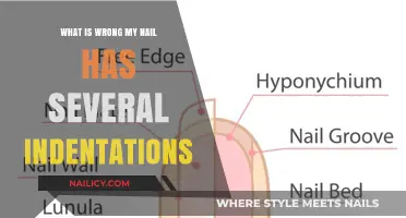 Nail Indentations Explained: Causes and Solutions for Your Nail Concerns