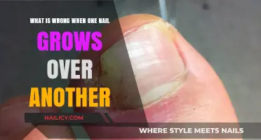 Nail Abnormalities: When Nails Grow Over Each Other