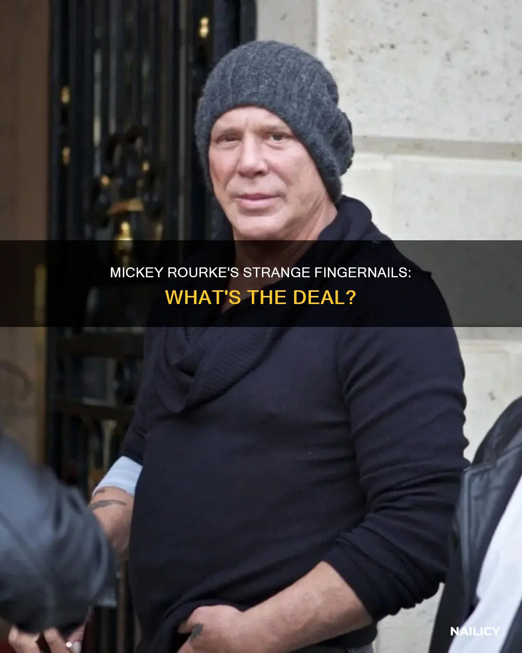 what is wrong with mickey rourke