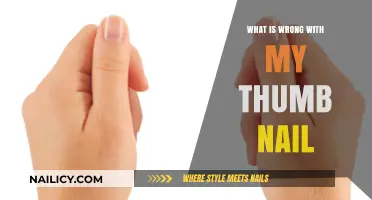 Why Is My Thumb Nail Discolored, Brittle, or Abnormal? Causes Explained