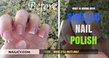 Shellac Nail Polish Problems: Common Issues and How to Fix Them
