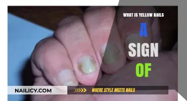 Yellow Nails: Uncovering Hidden Health Issues and Their Causes