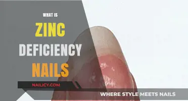 Zinc Deficiency Nails: Symptoms, Causes, and Treatment Explained