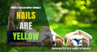 Why Are My Toenails Yellow? Understanding the Causes and Treatments