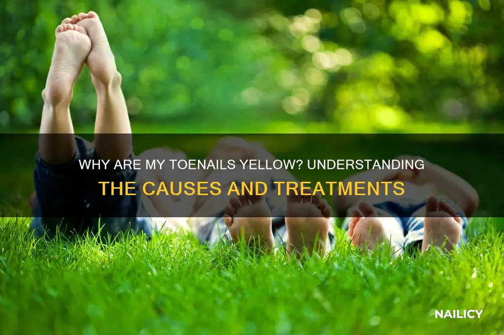 what it called when toenails nails are yellow