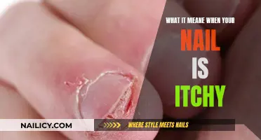 Unraveling the Mystery: Why Your Nails Itch