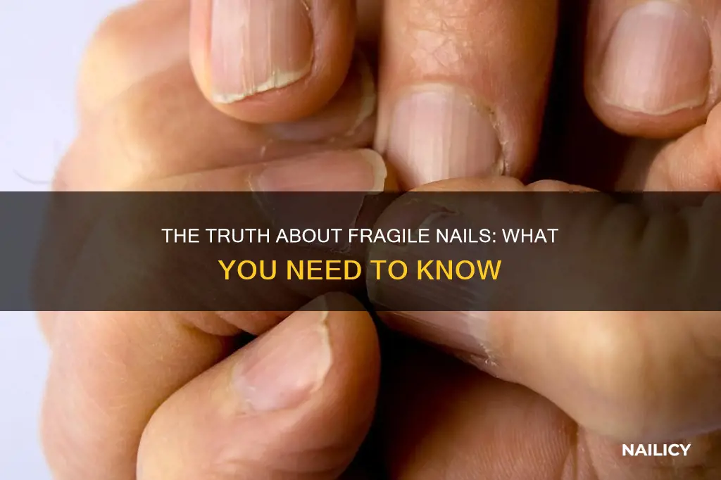 what it means to have fragile nails