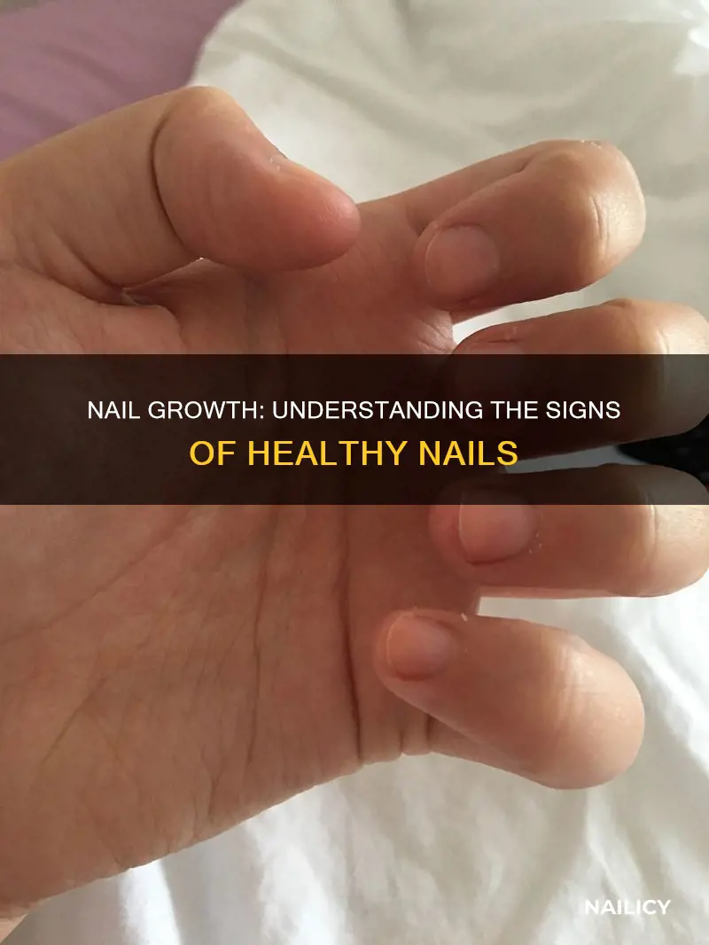 what it means when nails lify