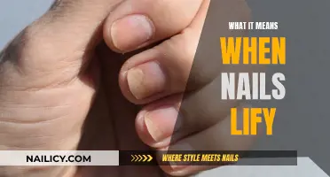 Nail Lifting: What It Means and How to Address It