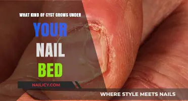 Nail Bed Cysts: Causes, Symptoms, and Treatment