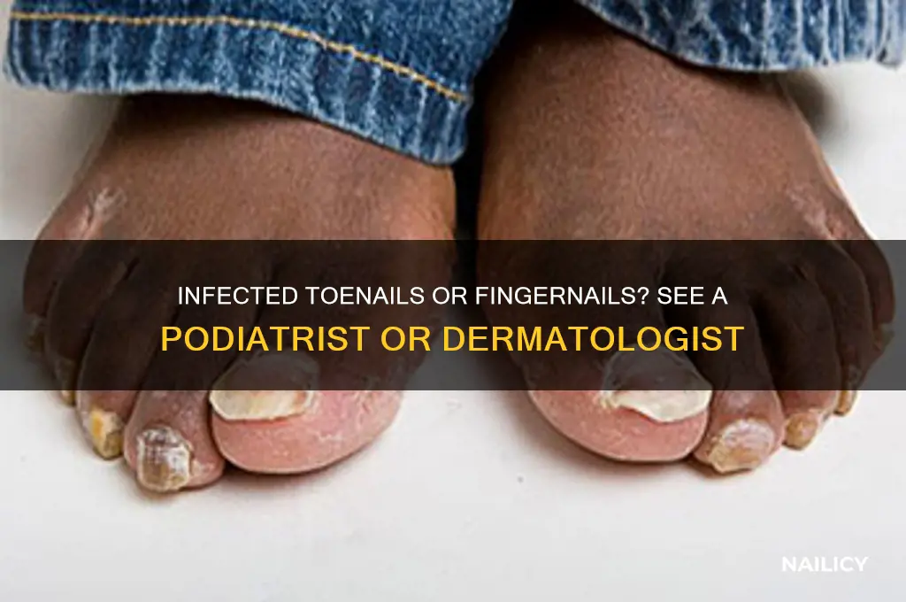 what kind of doctor deals with infected nails