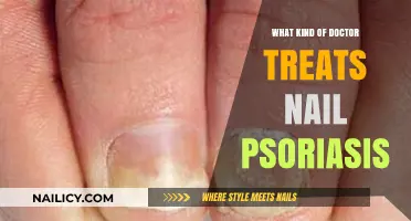 Which Specialist Treats Nail Psoriasis? A Comprehensive Guide