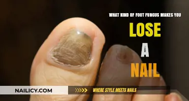 Toenail Fungus: Understanding the Type That Causes Nail Loss