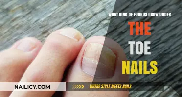 Fungal Infections Under Toenails: Causes and Remedies