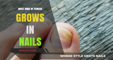 Fungal Nail Infections: Causes and Treatments