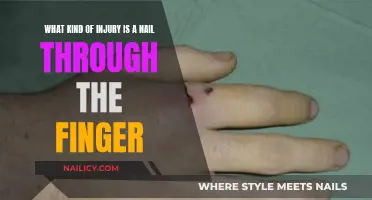 Nail-Pierced Finger: Understanding the Injury and Its Treatment