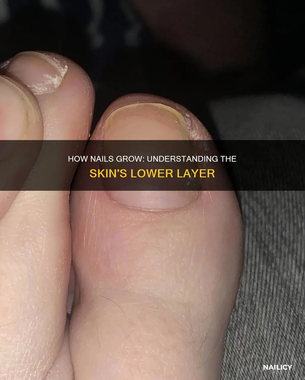 what layer of skin does nails grow