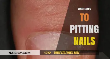 Understanding Pitting Nails: Causes, Symptoms, and Effective Treatment Options
