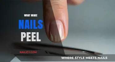 Why Do Nails Peel? Causes, Prevention, and Effective Solutions