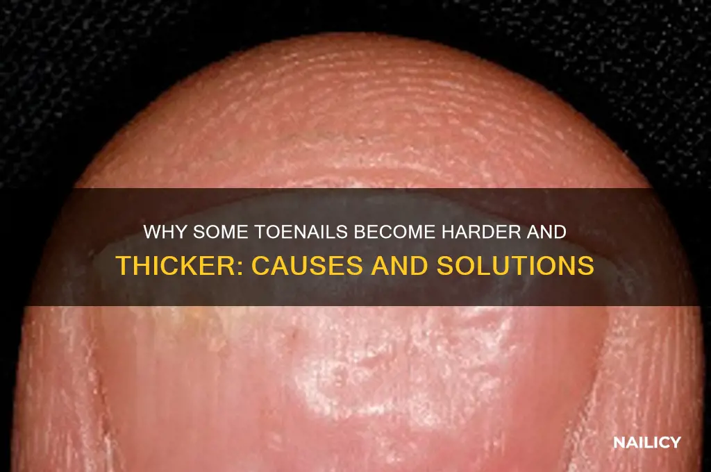 what make some toe nails harder and thicker