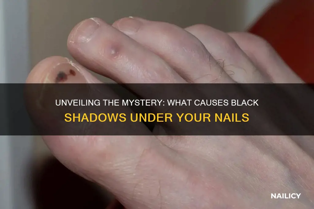 what makes a black shadow under the finger nails