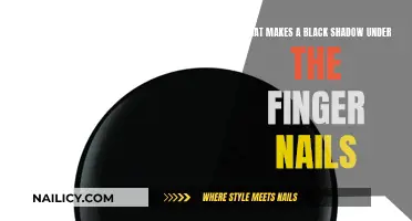 Black Shadow Under Fingernails: What's the Cause?