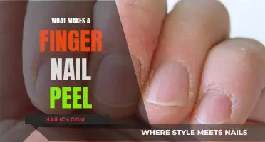 Unraveling the Mystery: Why Do Finger Nails Peel?