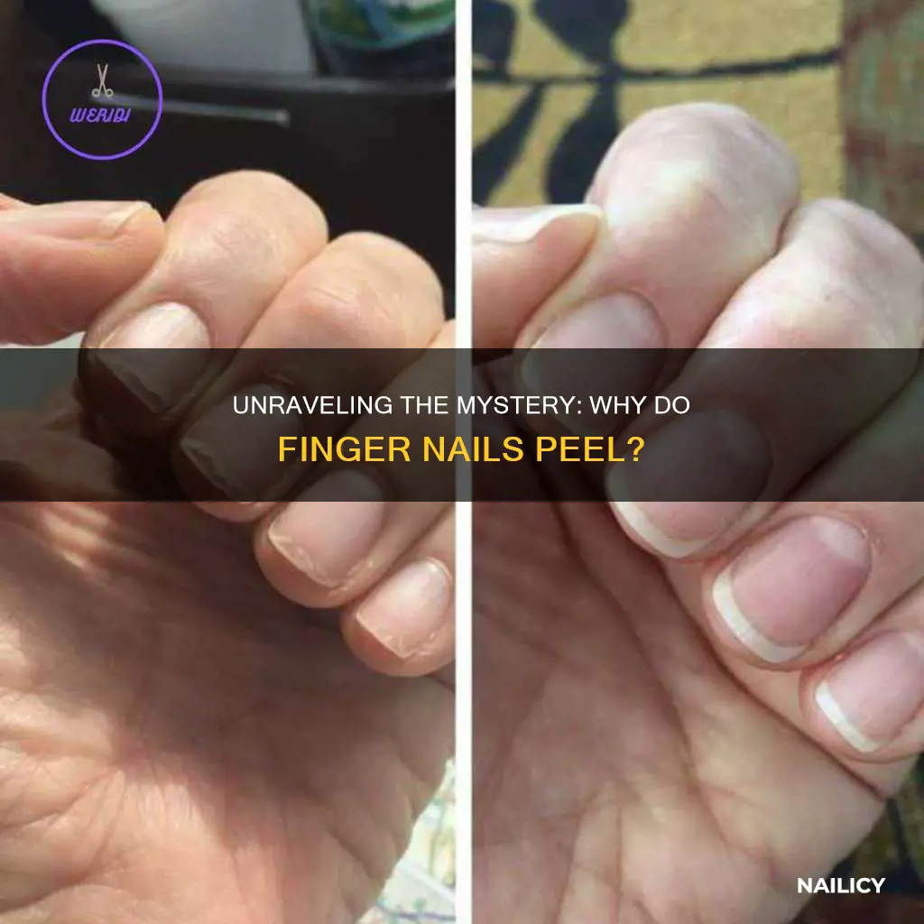 what makes a finger nail peel