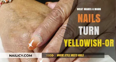 Why Men's Nails Turn Yellowish-Orange: Causes and Solutions