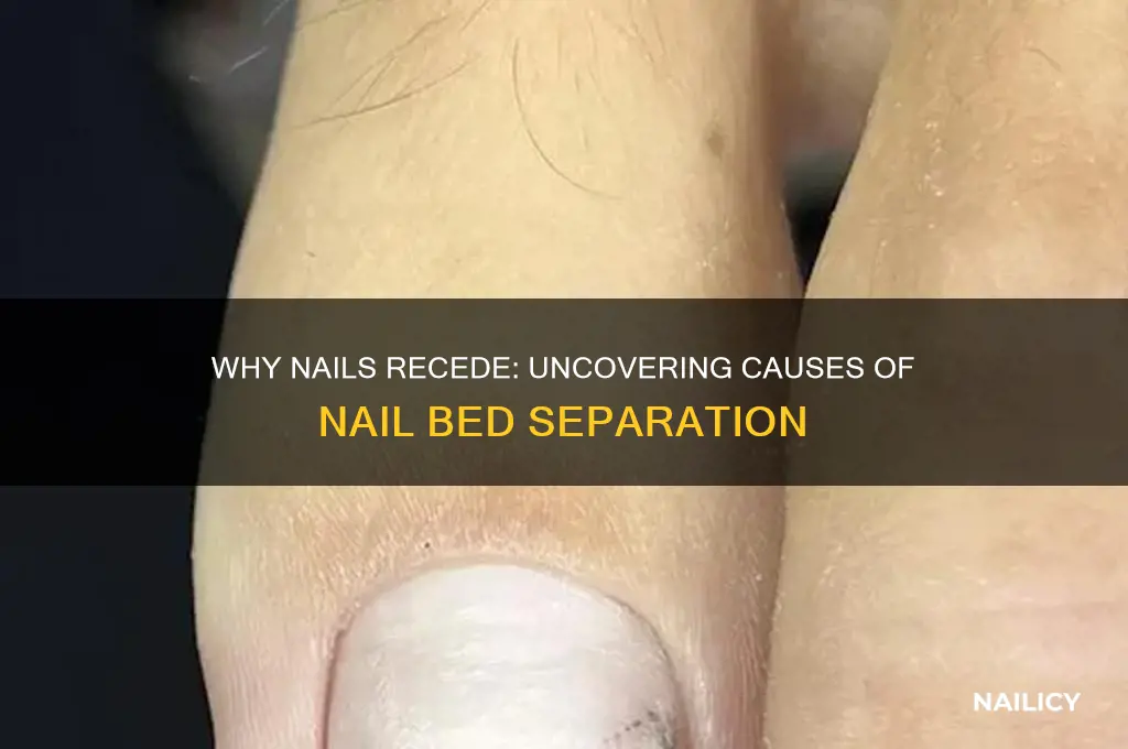 what makes a nail start receding from the bed
