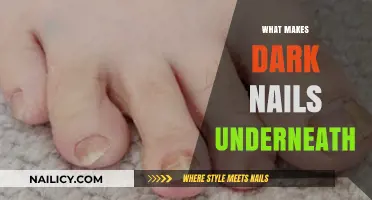 Understanding Dark Nails: Causes, Concerns, and When to Seek Help