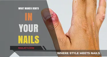 Unveiling the Causes Behind Mysterious Dents in Your Fingernails