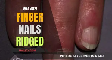 Understanding Vertical Ridges on Fingernails: Causes and Treatments