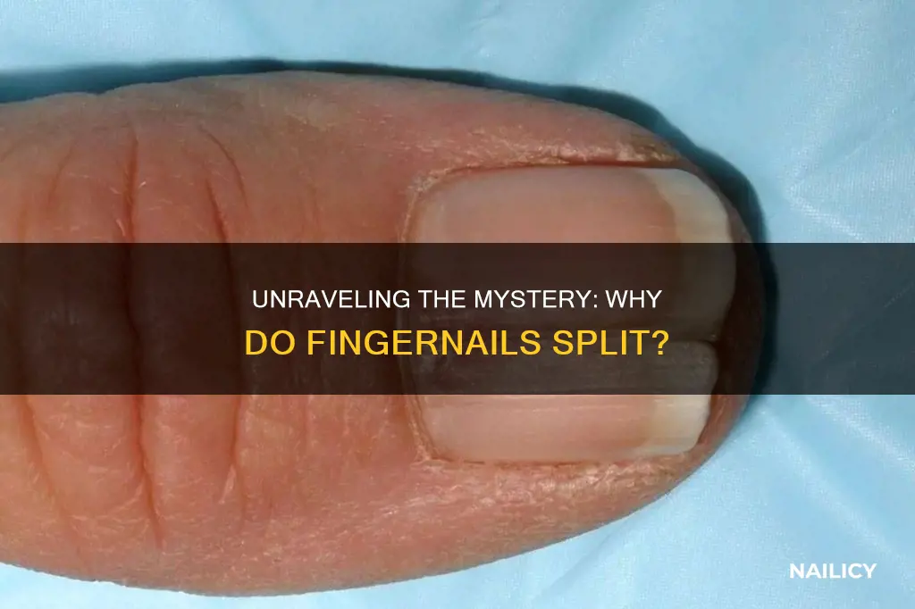 what makes finger nails split