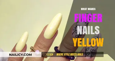 Why Do Fingernails Turn Yellow? Causes and Solutions Explained