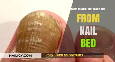 Why Fingernails Lift: Causes, Prevention, and Treatment Explained