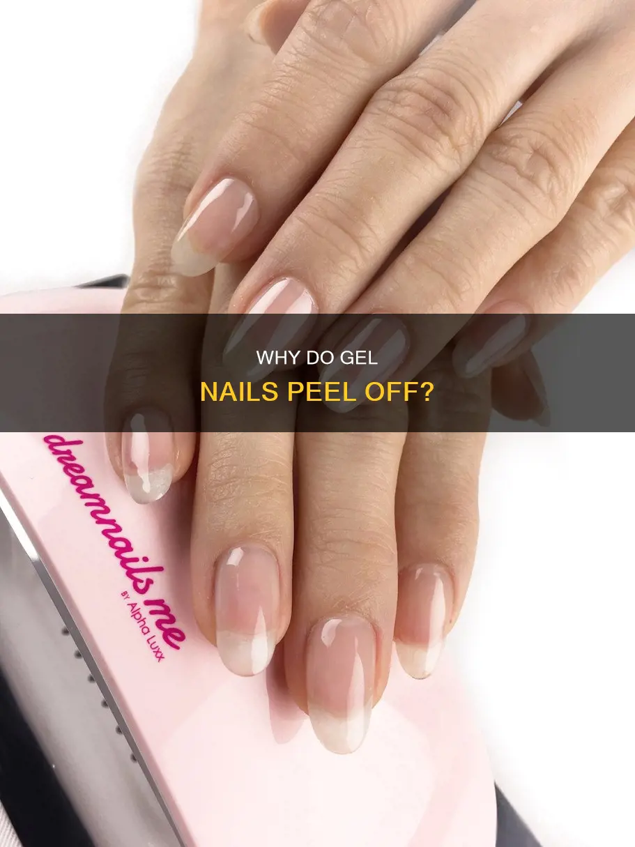 what makes gel nails peel