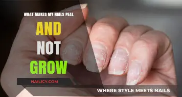 How to Fix Peeling Nails and Stimulate Growth