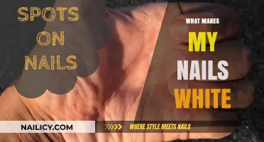 Why Are My Nails White? Causes, Concerns, and Care Tips