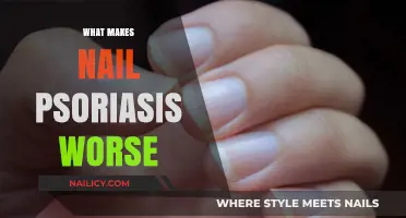 Understanding Nail Psoriasis Triggers: Factors That Worsen Symptoms and Flare-Ups