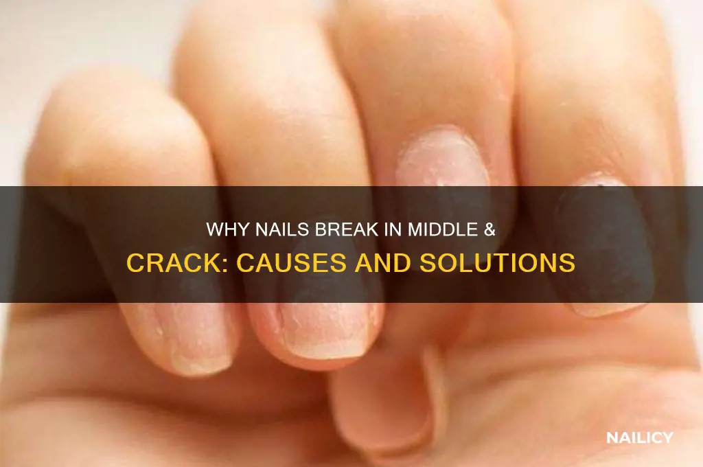 what makes nails break in middle & crack