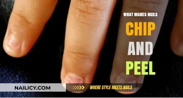 Why Nails Chip and Peel: Causes and Prevention Tips